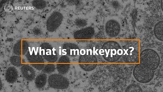 What is monkeypox and how dangerous is it [upl. by Draper]