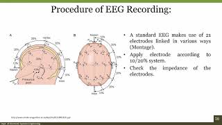 Learn to Read EEGs Part 1 [upl. by Nylicaj559]