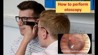 How to perform Otoscopy Ear Exam [upl. by Grace]