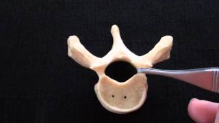 Typical Vertebra  Spinal column  Anatomy [upl. by Heyward]