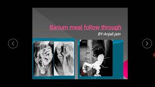 Barium meal follow through [upl. by Willy]