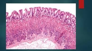 HISTOLOGIA DEL ESTOMAGO [upl. by Haney119]