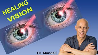 Lazy Eye Exercises  Lazy eye Training  Eye exercise to improve Vision [upl. by Nossah]