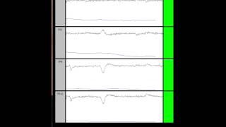 BrainAvatar Muse EEG [upl. by Jeanine]