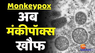 Corona के बाद अब Monkeypox Virus का खौफ [upl. by Ezara]