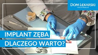 Implanty zębów Dlaczego warto [upl. by Kiraa]