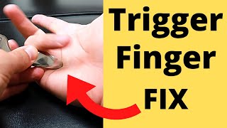 FIX Trigger Finger in 5 Minutes 3 Steps [upl. by Retniw]