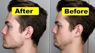 How To Get A Strong Chin And Jawline Lose Double Chin [upl. by Aidan]