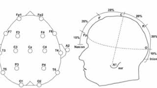 Electroencephalograph EEG [upl. by Droflim678]