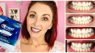 Crest 3D White One Hour Express Whitestrips CREST WHITENING BEFORE AND AFTER REVIEW [upl. by Arayt]