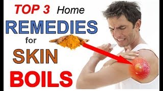 Top 3 Home Remedies for Skin Boils THAT WORK  How to Get Rid of Skin Boils in 3 Easy Steps [upl. by Icaj]