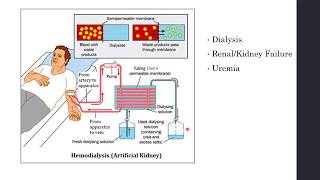 Disorders of Excretory System  Haemodialysis Artificial Kidney  Biology Class 11NEET [upl. by Kristos874]