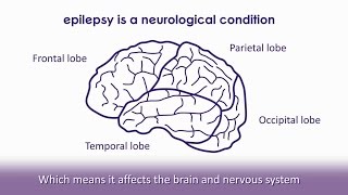 Epileptic Seizure recorded on electroencephalogram EEG [upl. by Bbor58]