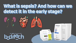 Pathophysiology of Sepsis  MicroPharm [upl. by Nnylsoj483]