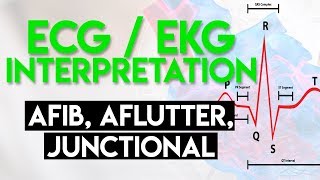 Afib Aflutter Junctional Arrhythmias  ECG EKG Interpretation Part 4 [upl. by Leese]