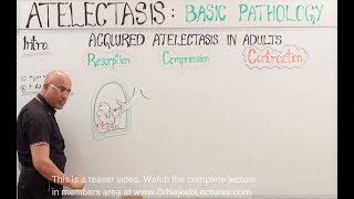 Atelectasis  Resorption Compression and Contraction [upl. by Ginny]