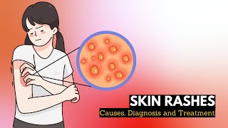 Skin Rash Causes Signs and Symptoms Diagnosis and Treatment [upl. by Aisiat]