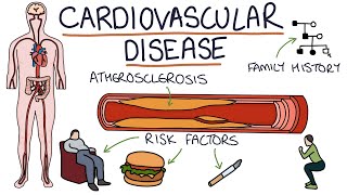 Understanding Cardiovascular Disease Visual Explanation for Students [upl. by Farmann156]