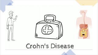 Crohns Disease A quick overview of everything you should know [upl. by Henrietta]