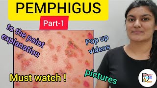 SKIN LESIONS PEMPHIGUS PART1 [upl. by Carlye336]