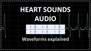 Normal Heart Sounds  Auscultation  Audio [upl. by Atsok]