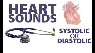 Heart Sounds Summary  Systolic amp Diastolic Sounds [upl. by Wj]