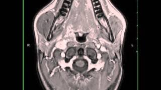 Introduction to Radiology Computed Tomography [upl. by Sauncho986]