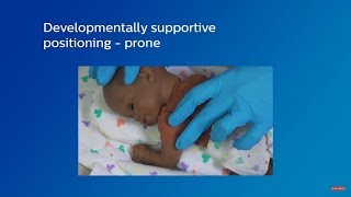 Developmentally supportive infant positioning  prone [upl. by Lynnette639]