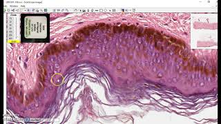 Keratinized stratified squamous epithelium [upl. by Akehs191]