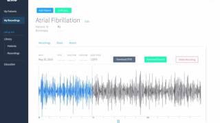 Eko Digital Stethoscope  Atrial Fibrillation [upl. by Aihsenek]