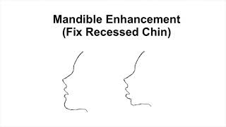 Mandible Enhancement  Fix Recessed Chin  V Shaped Face Subliminal [upl. by Yddeg]