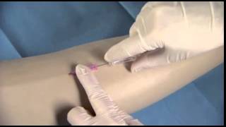 BD Insyte™ Autoguard™ Shielded IV Catheter Insertion Technique [upl. by Hanako174]